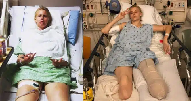 Lauren Wasser avant son amputation