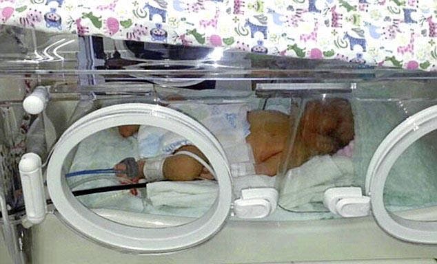 Le bébé prématuré aux soins intensifs
