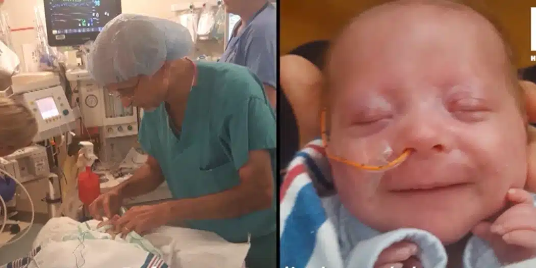 Mathieu, bébé prématuré, entouré de câbles médicaux en néonatalogie