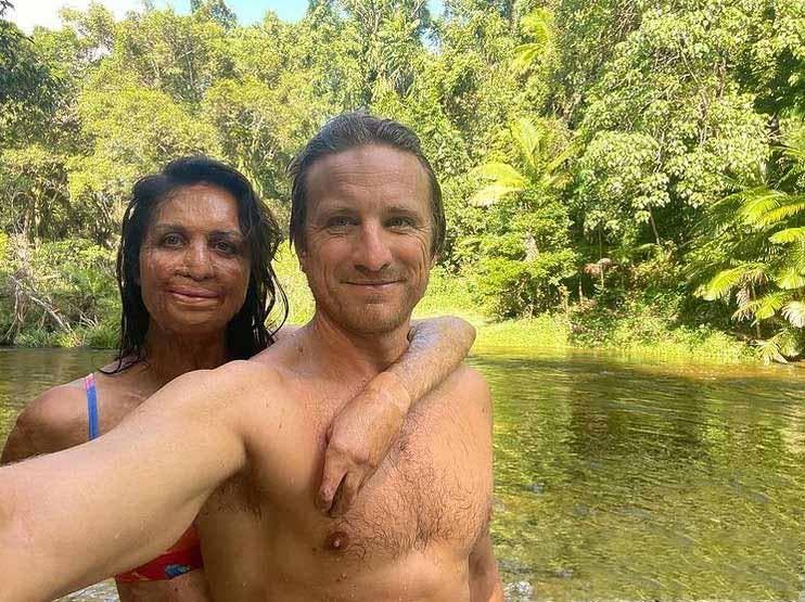 Turia Pitt et son mari