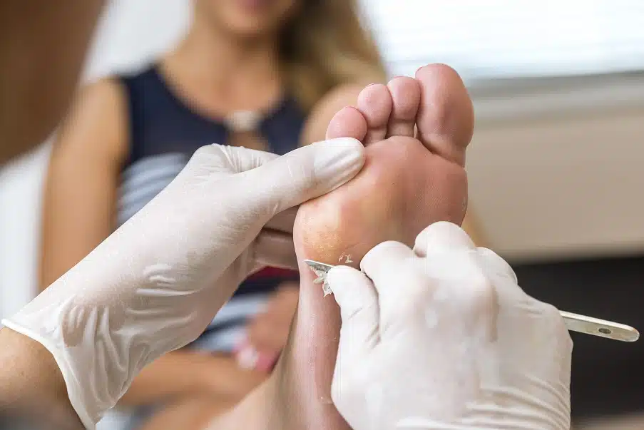 Consultation chez un dermatologue