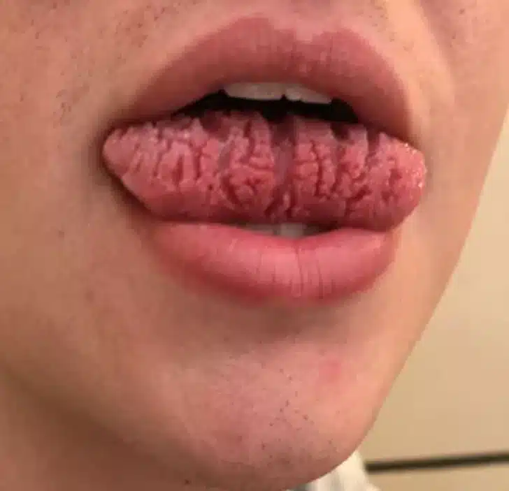 Forme de langue particulière