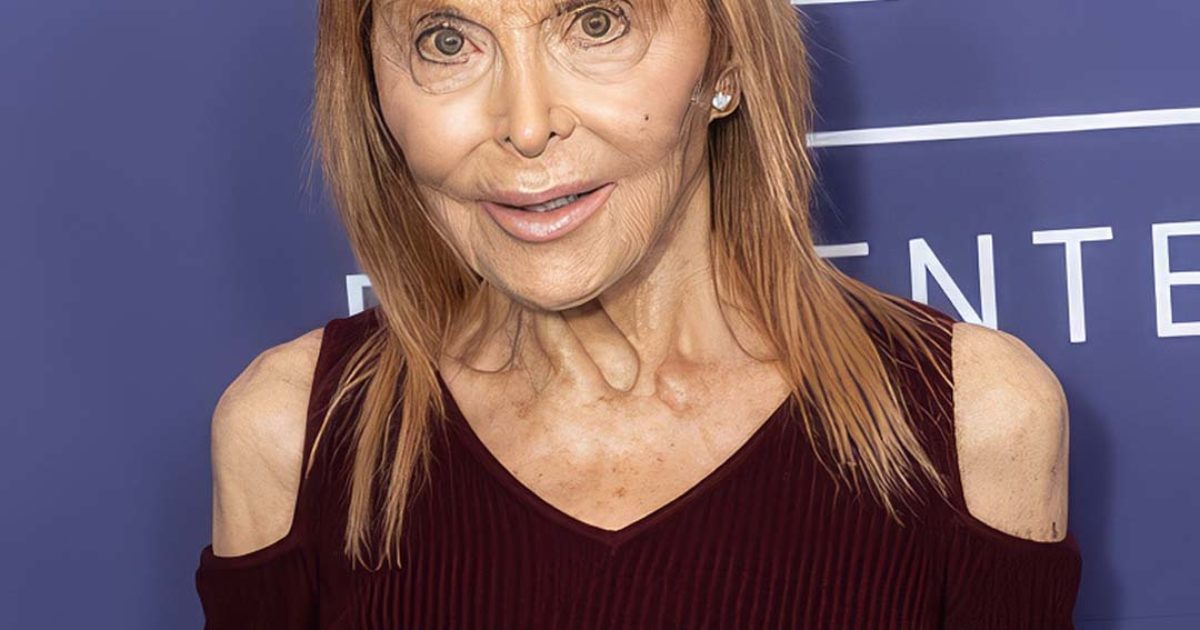 Brigitte Bardot, Tara Reid, Mickey Rourke... ces stars qui ont très mal vieilli