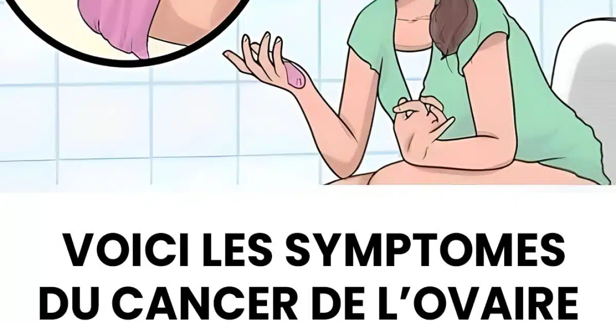 Cancer de l'ovaire : voici les symptômes précoces les plus courants