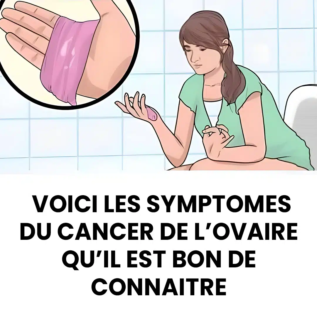 Cancer de l'ovaire : voici les symptômes précoces les plus courants