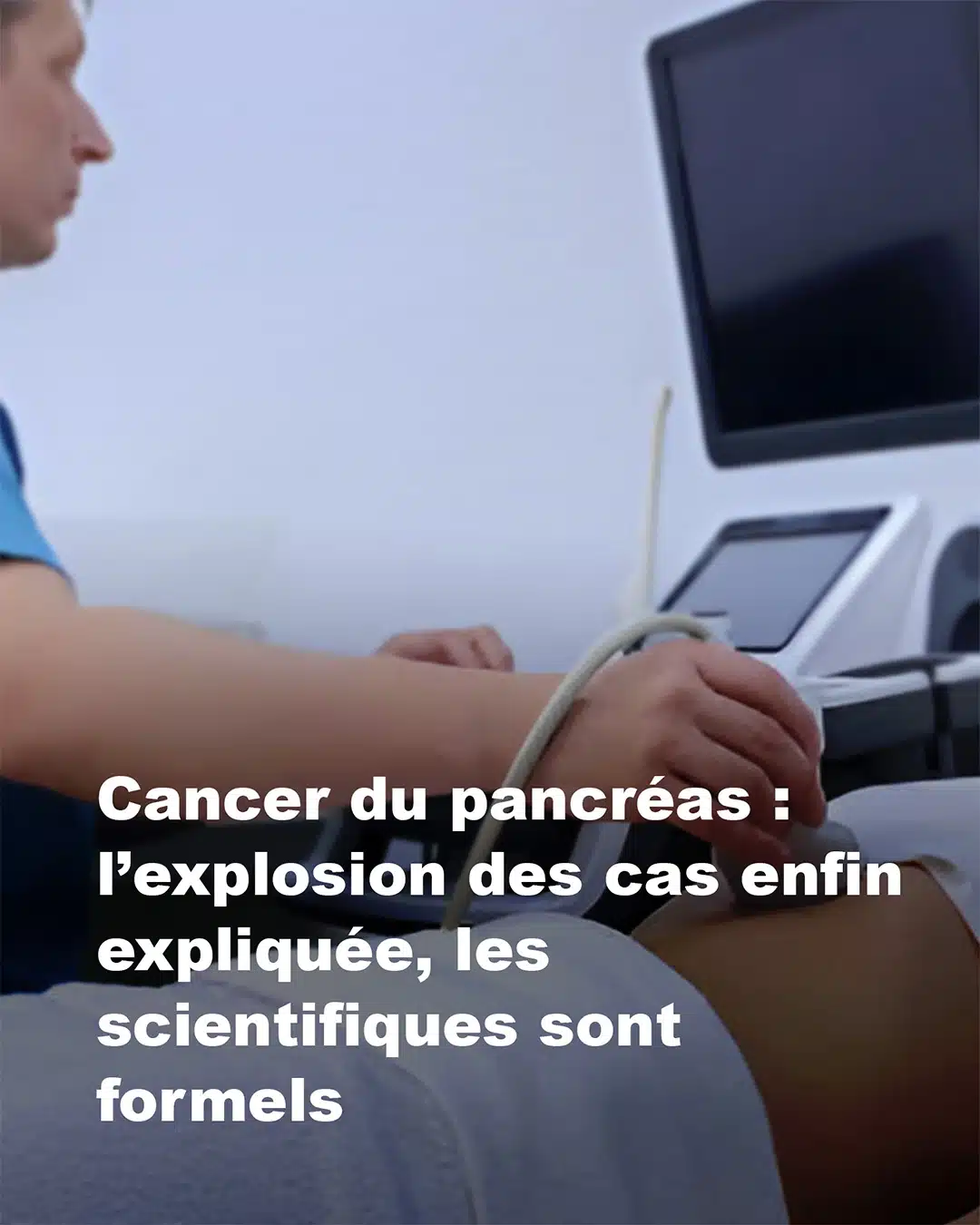 Cancer du pancréas : les scientifiques lèvent enfin le voile sur l’explosion des cas