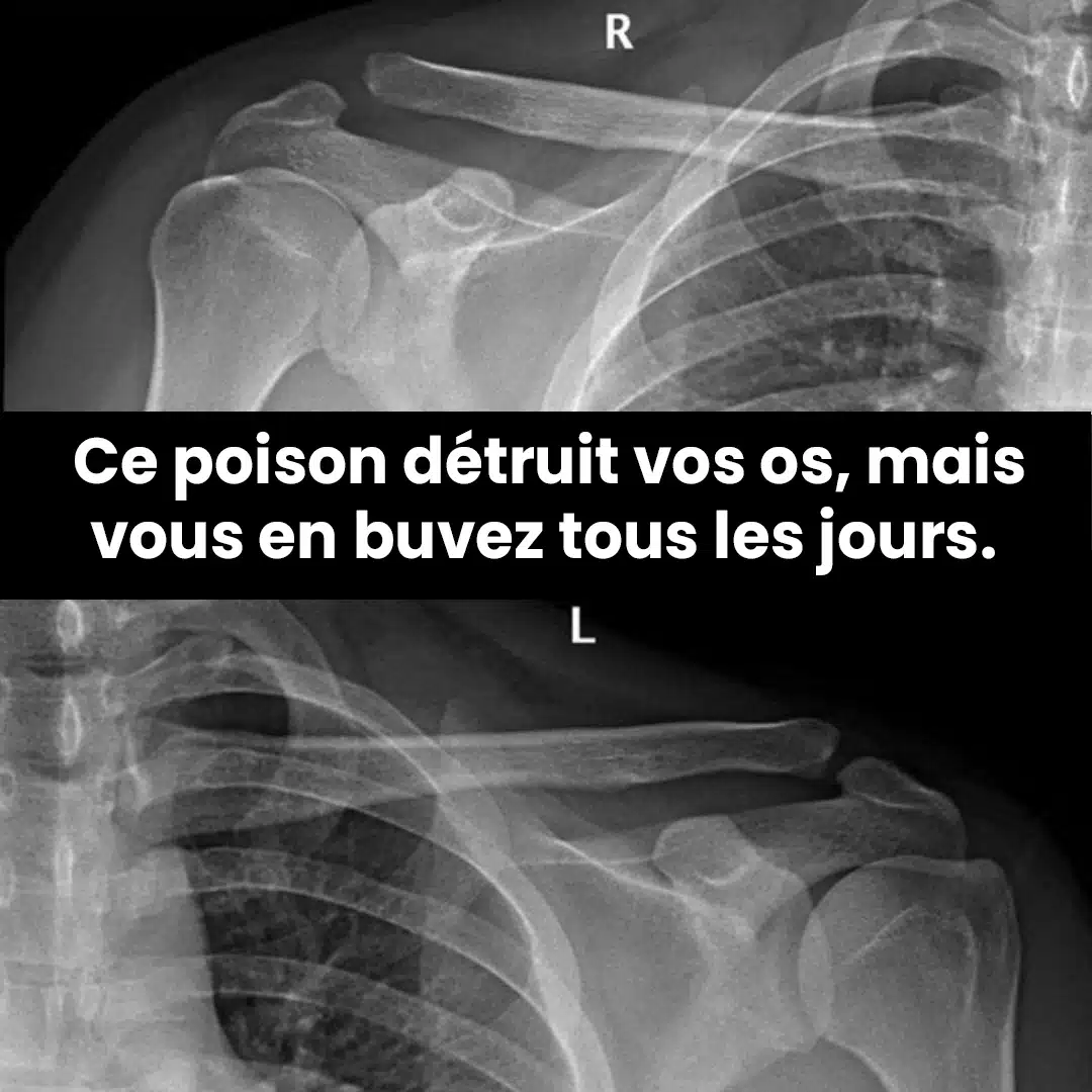 Ce produit présente un risque pour les os, et beaucoup de gens en consomment chaque jour