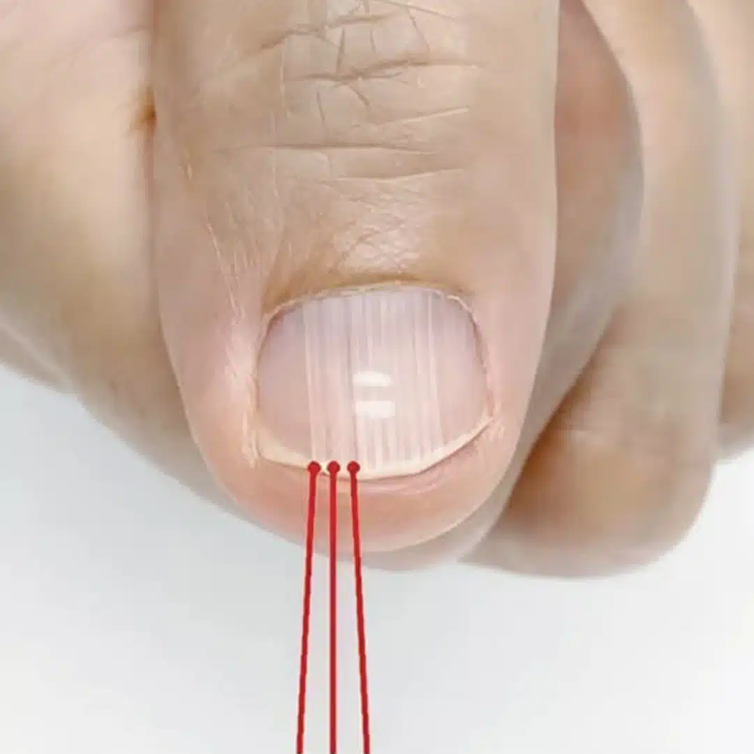 Ce que ces lignes verticales sur vos ongles révèlent réellement