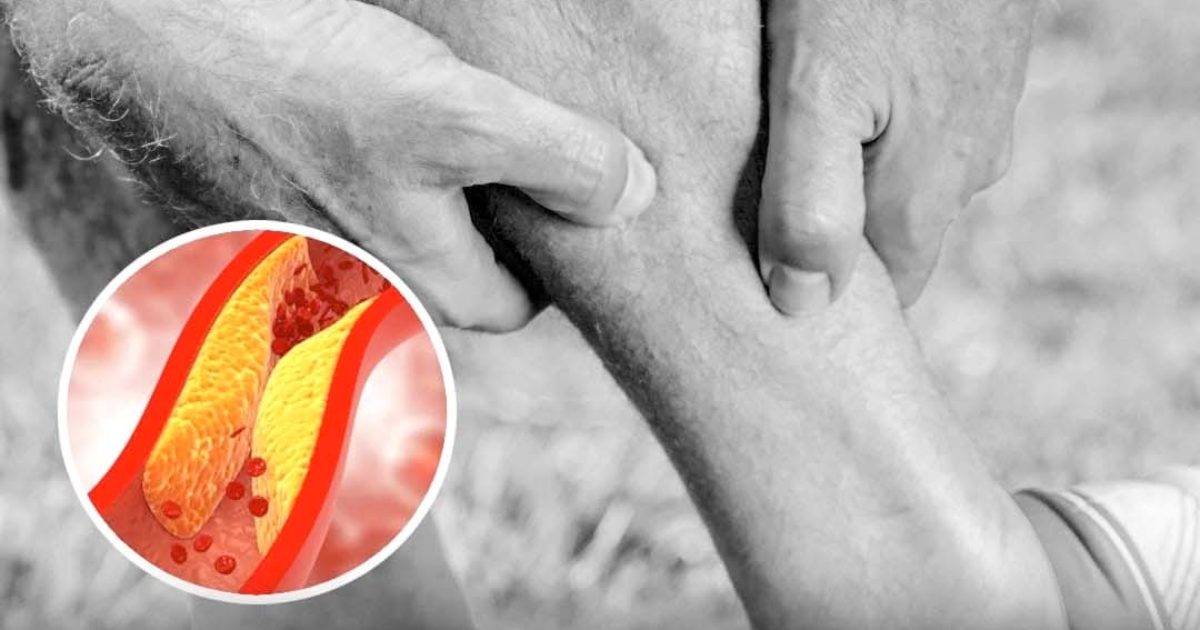 Ce que vos pieds peuvent révéler sur les problèmes cardiaques
