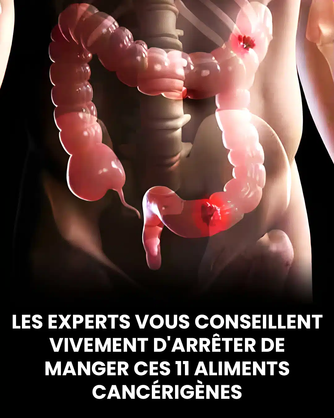 Ces 11 aliments qui semblent inoffensifs mais que les experts recommandent de ne plus consommer