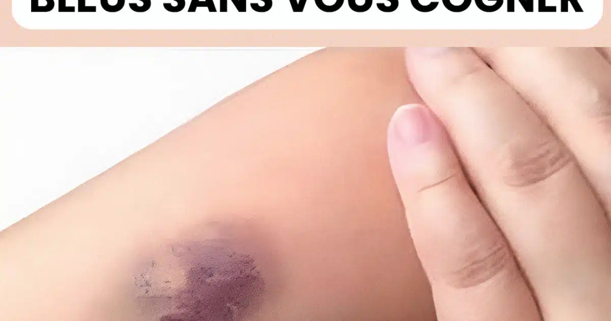 C'est la raison pour laquelle vous avez des bleus sur votre corps sans vous cogner