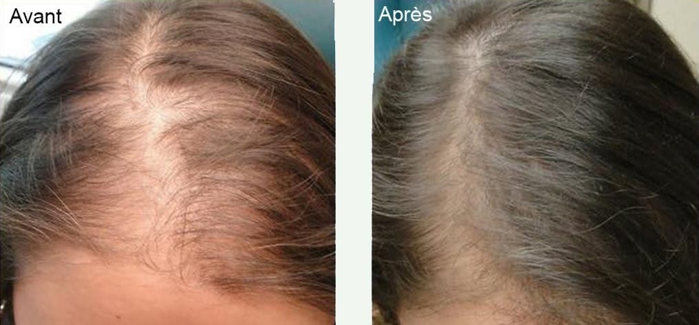 Comparaison avant-après de cheveux, plus brillants et volumineux