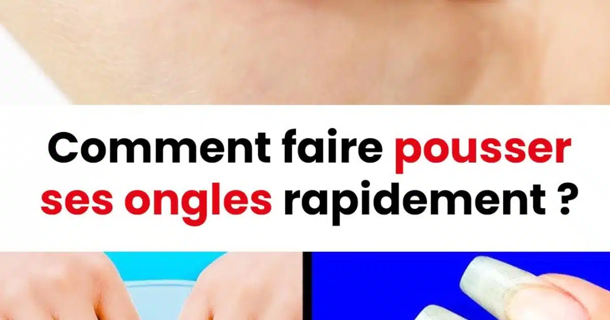 Comment accélérer la croissance de ses ongles ?