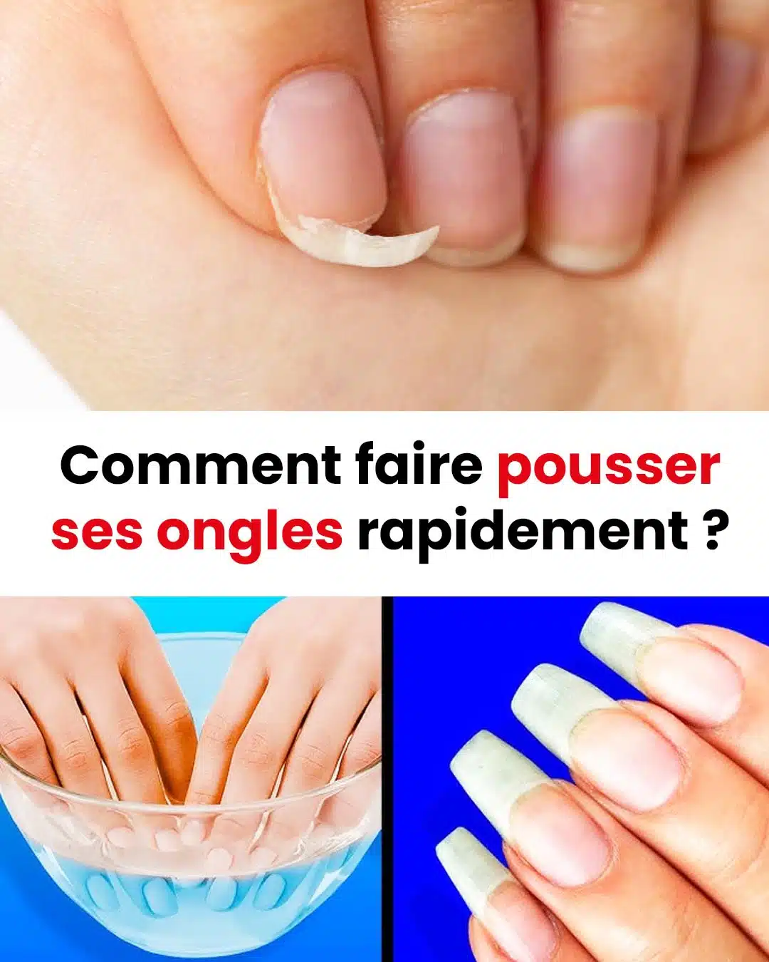 Comment accélérer la croissance de ses ongles ?