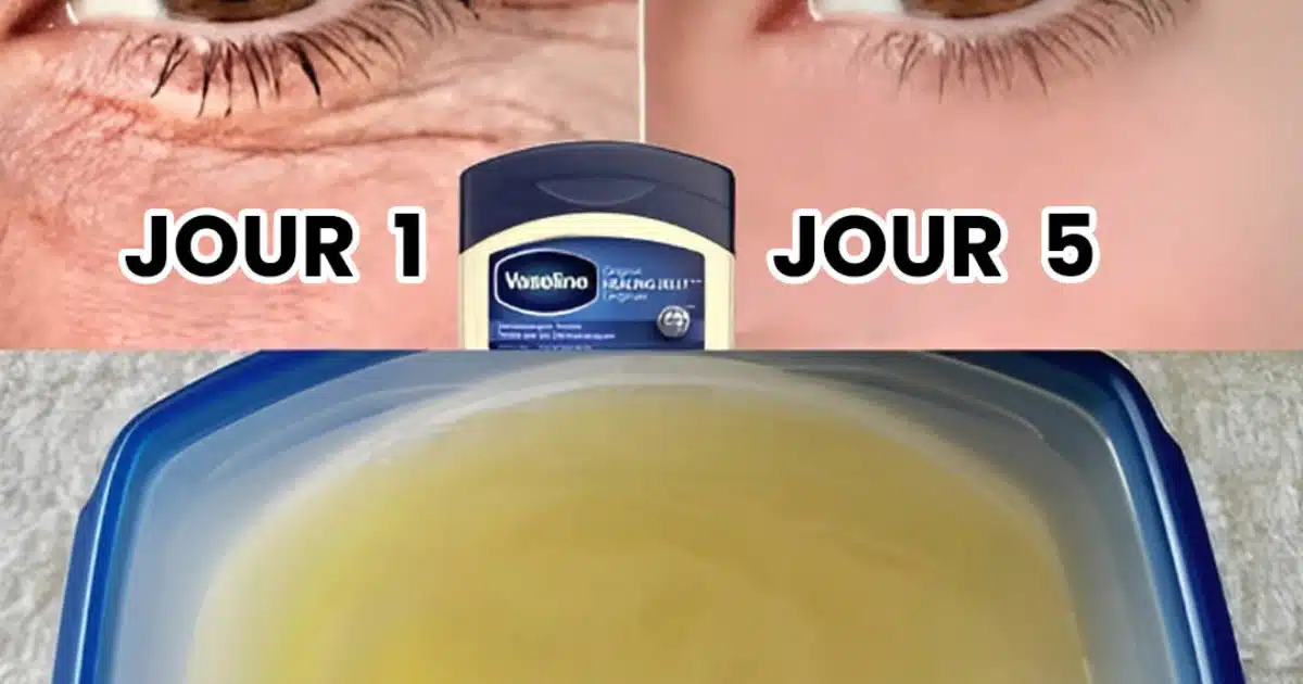 Comment avoir l’air plus jeune grâce à la vaseline ?