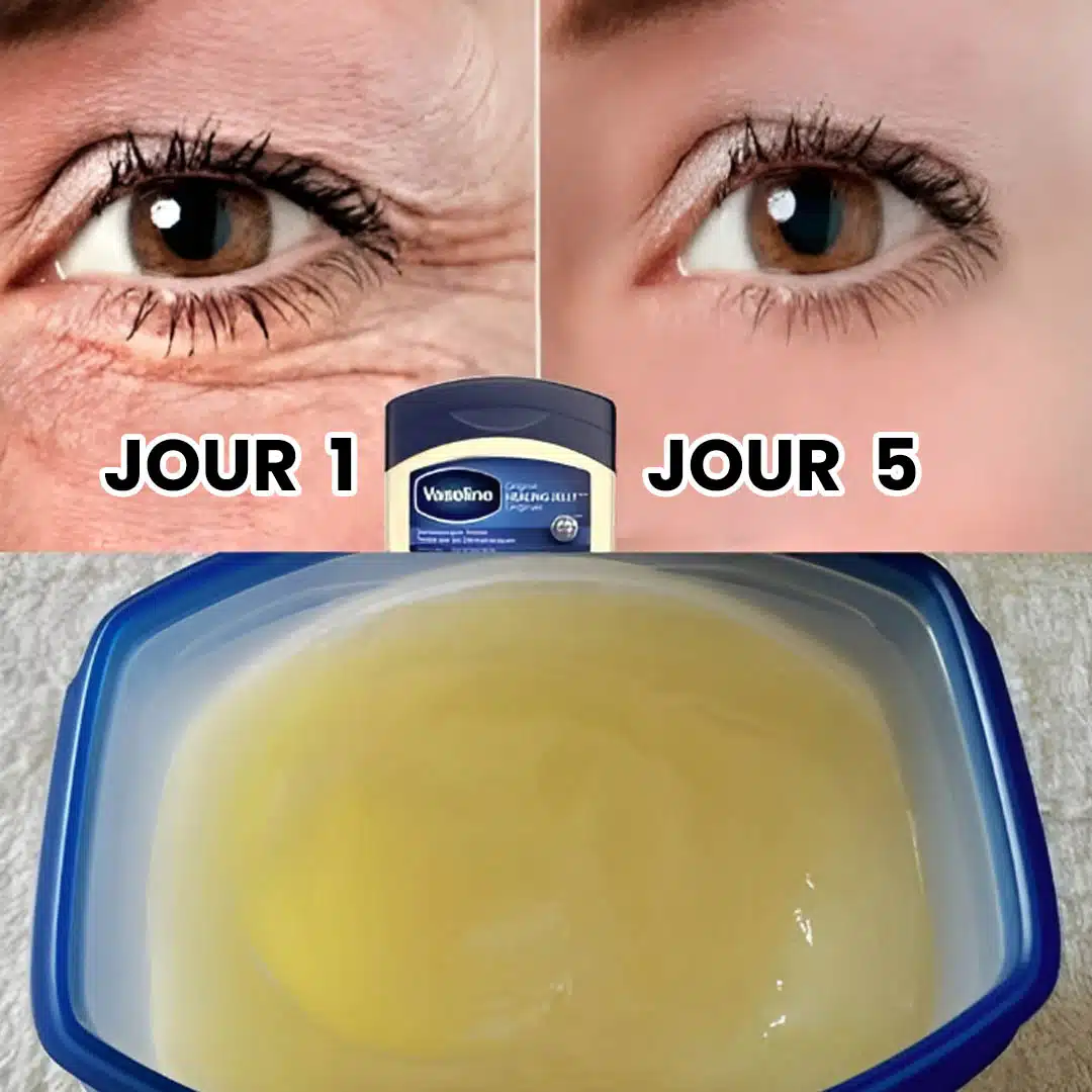 Comment avoir l’air plus jeune grâce à la vaseline ?