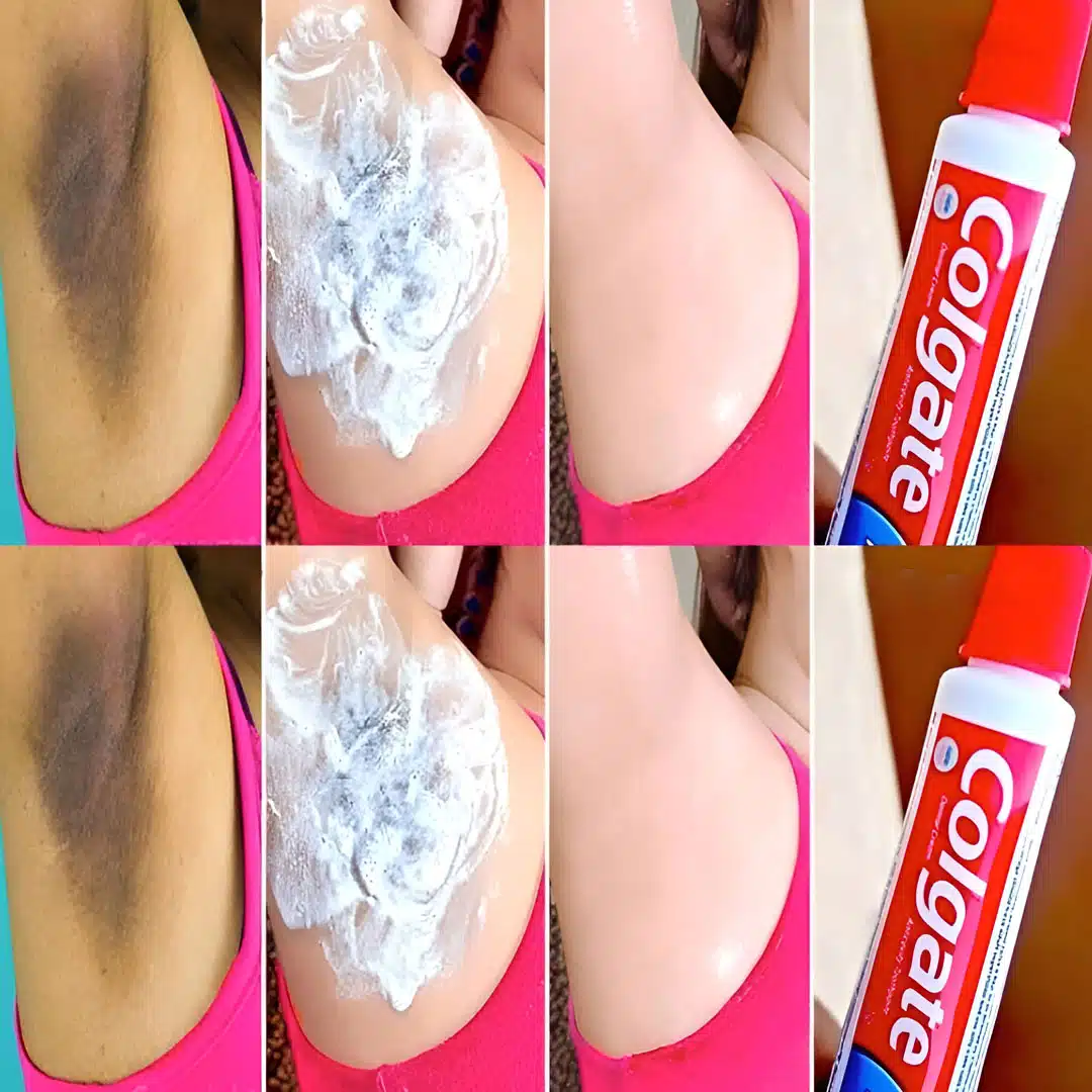 Comment blanchir les aisselles avec du dentifrice ?
