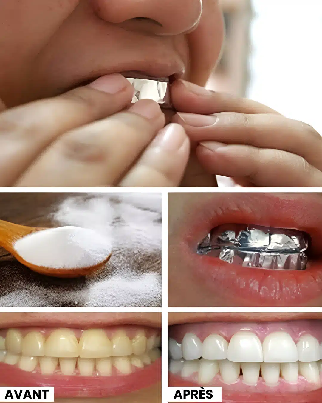Comment blanchir les dents avec du sel et de l'ail ?