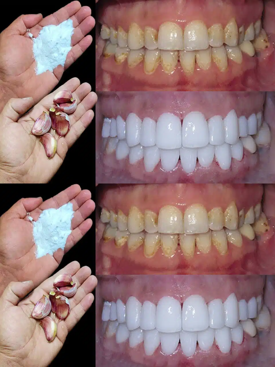 Comment blanchir les dents en 2 minutes ?