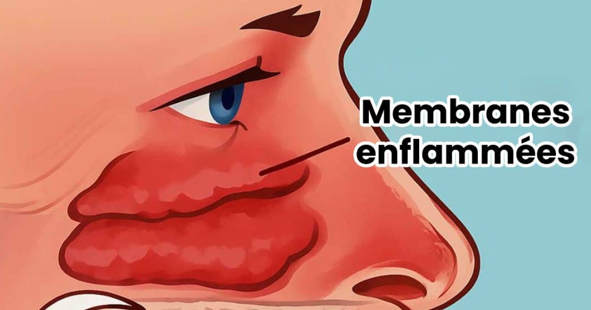 Comment dégager vos sinus naturellement ?