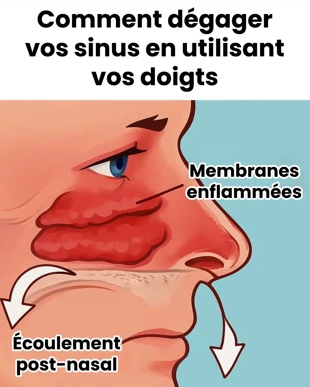 Comment dégager vos sinus naturellement ?