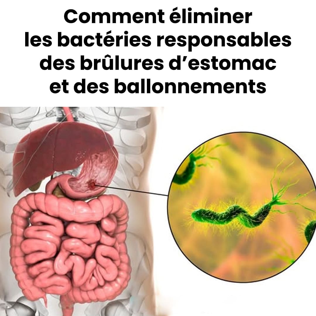 Comment éliminer les bactéries responsables des brûlures d'estomac et des ballonnements