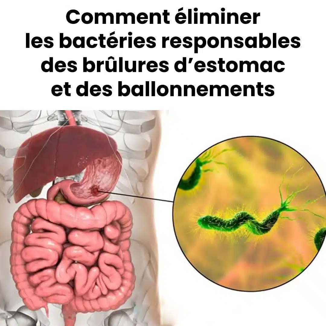 Comment éliminer les bactéries responsables des brûlures d'estomac et des ballonnements