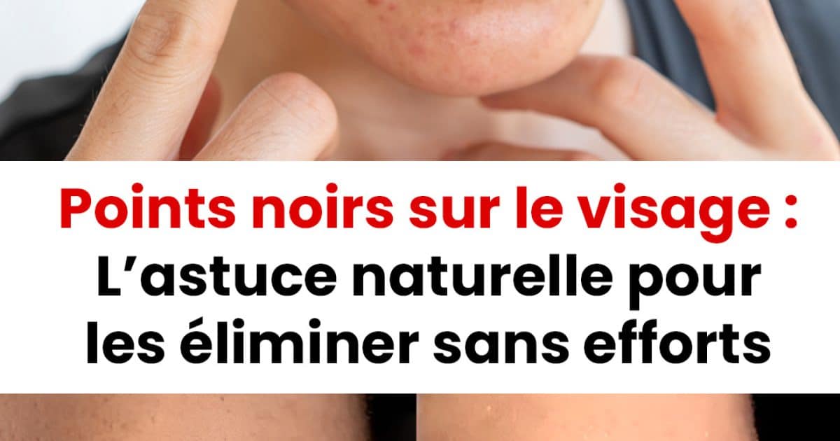 Comment éliminer les points noirs sur le visage ?