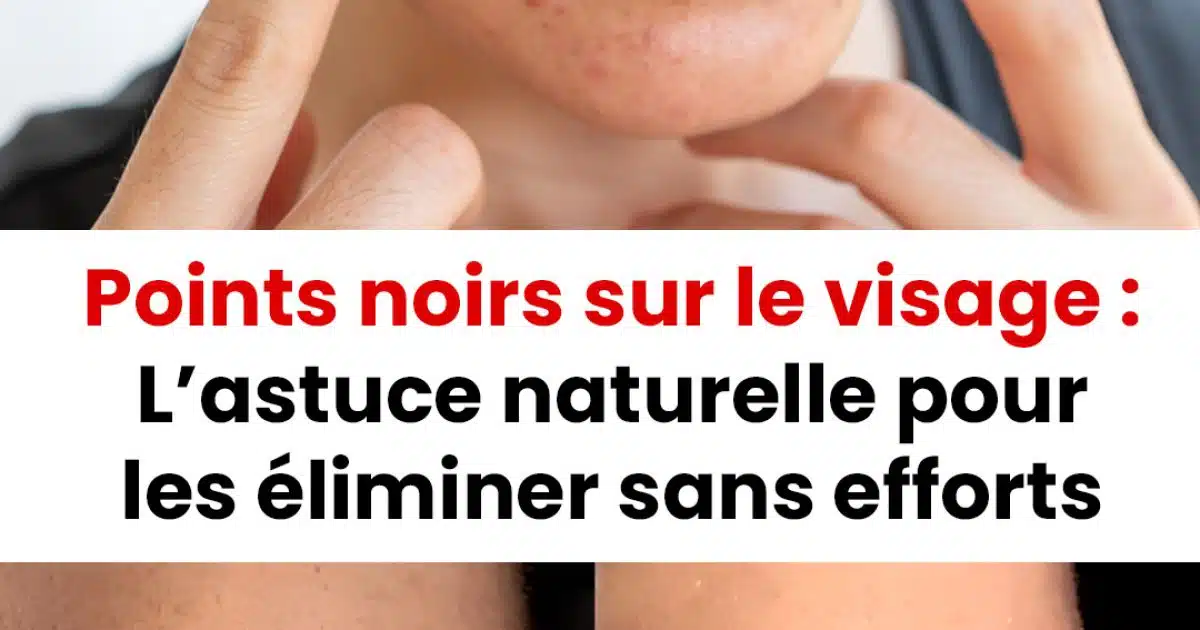 Comment éliminer les points noirs sur le visage ?