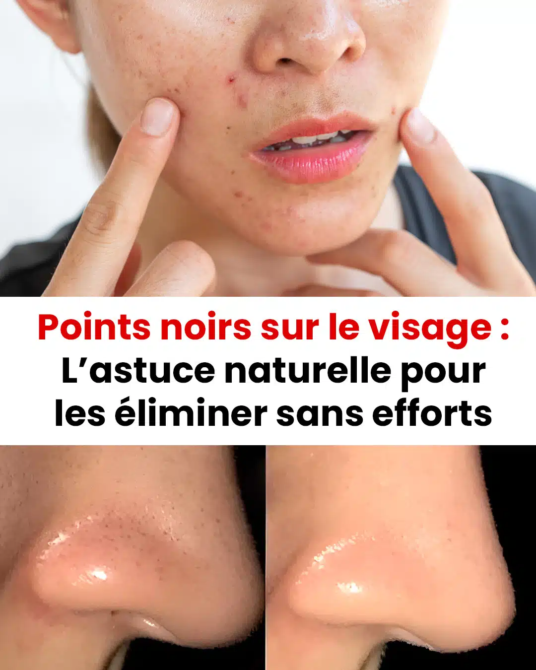 Comment éliminer les points noirs sur le visage ?