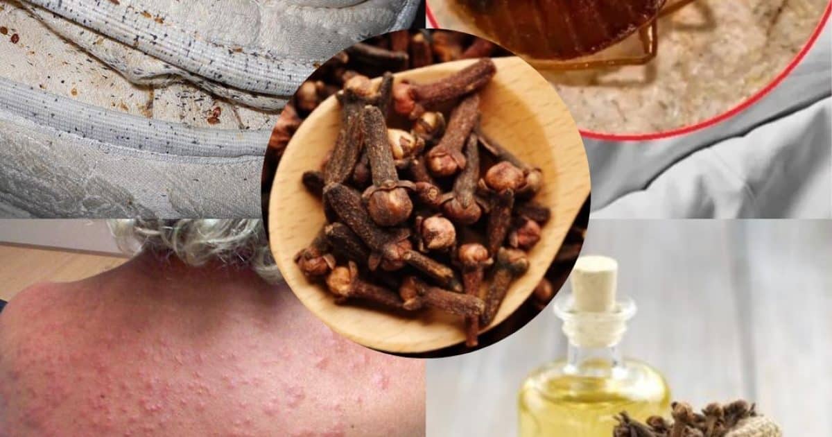 Comment éliminer les punaises de lit avec un mélange puissant à base de clous de girofle