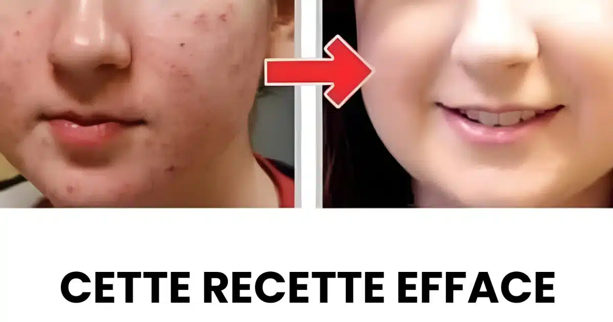 Comment éliminer les taches et les rides de votre visage ?