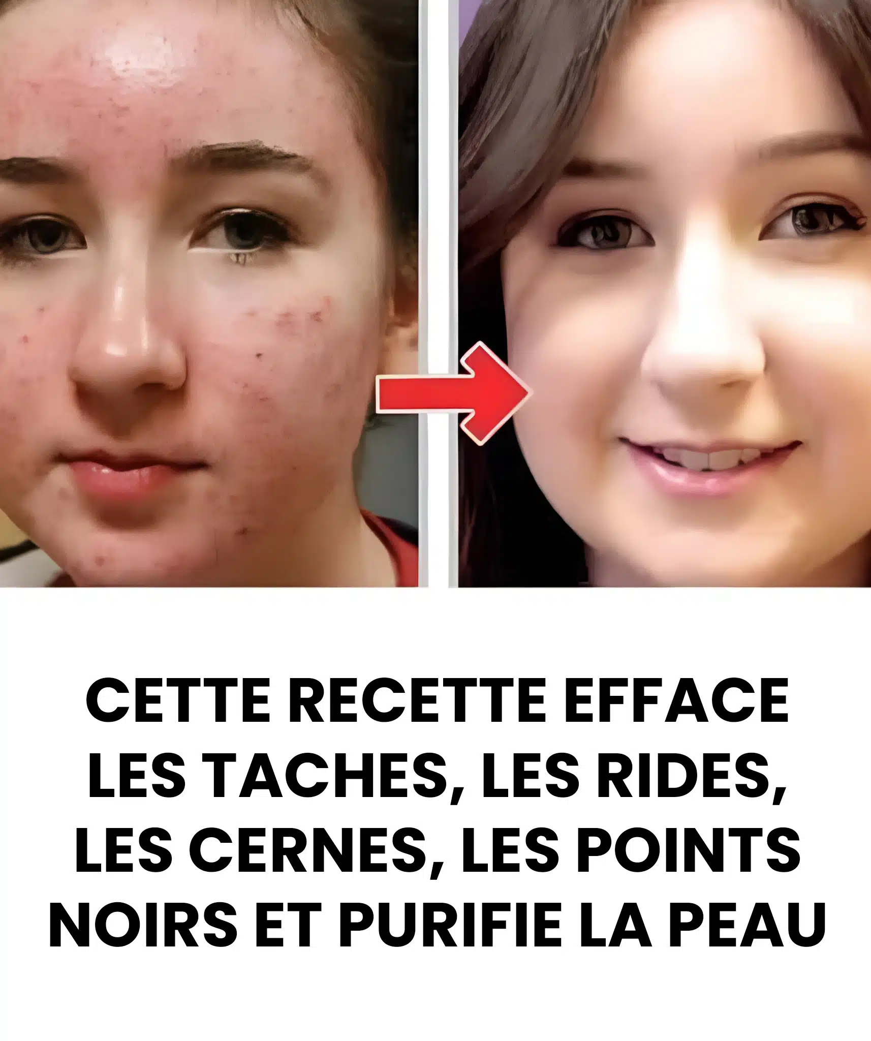 Comment éliminer les taches et les rides de votre visage ?