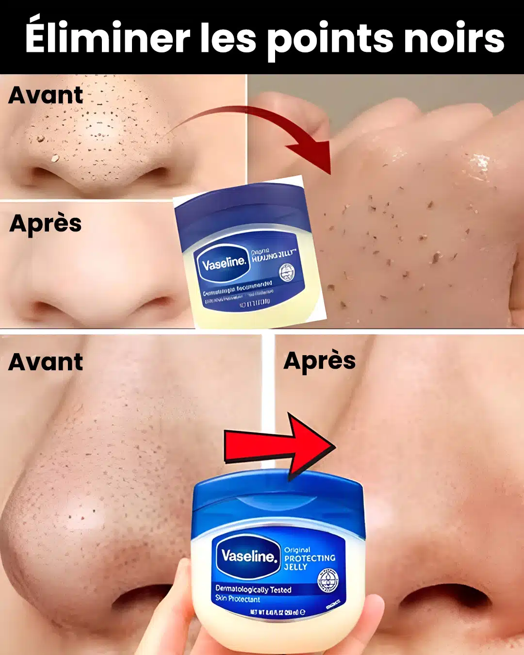 Comment éliminer naturellement les points noirs et blancs du nez et du visage avec de la vaseline