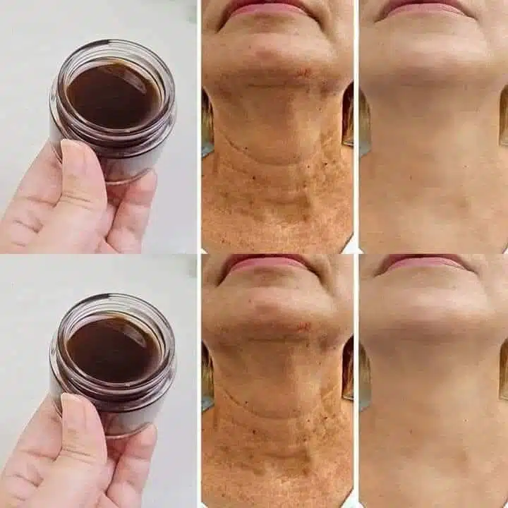 Comment estomper les rides du visage naturellement ?