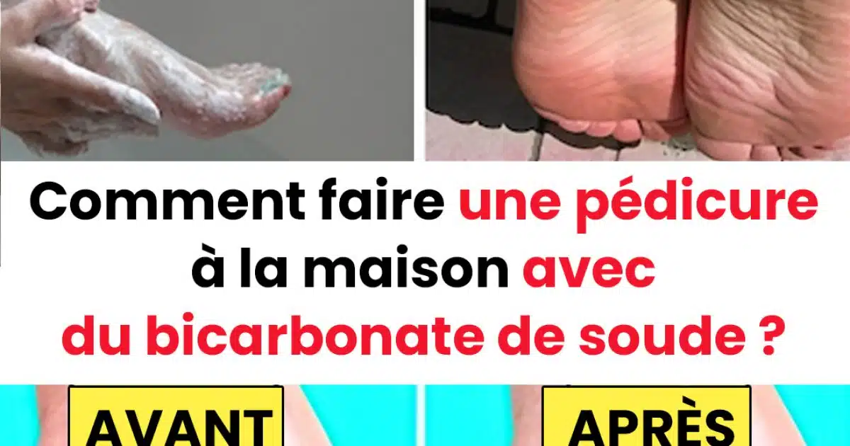 Comment faire une pédicure à la maison avec du bicarbonate de soude ?