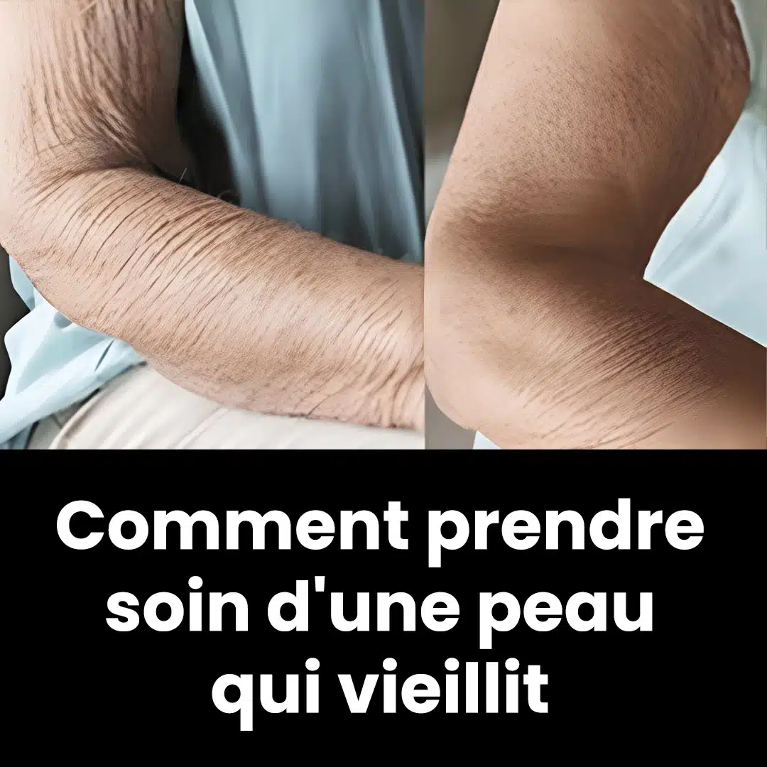 Comment prendre soin d'une peau qui vieillit