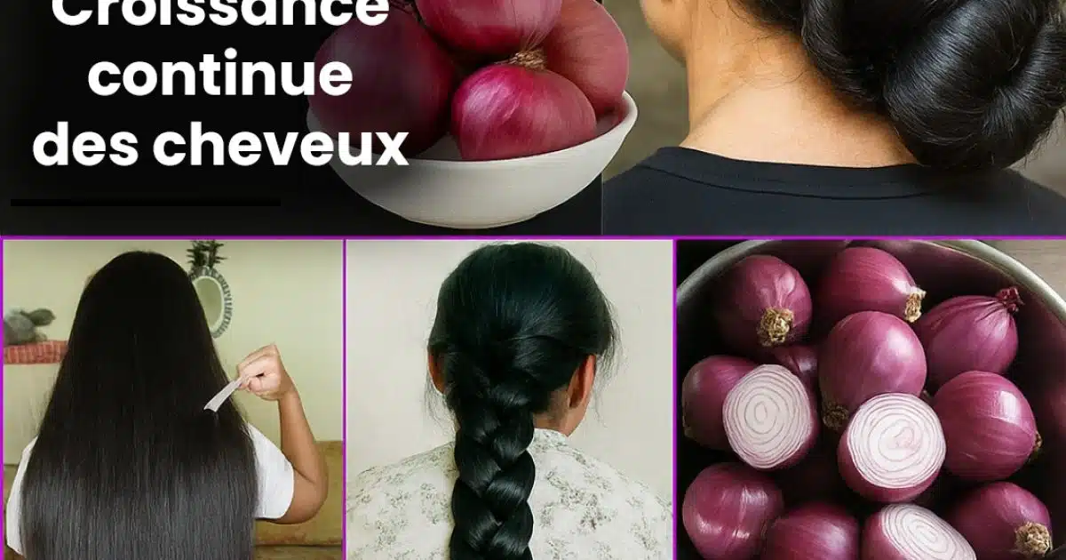 Comment préparer de l'huile d'oignon pour accélérer la croissance des cheveux et stopper leur chute ?