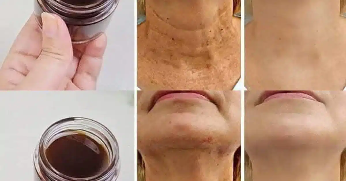 Comment rajeunir le visage naturellement