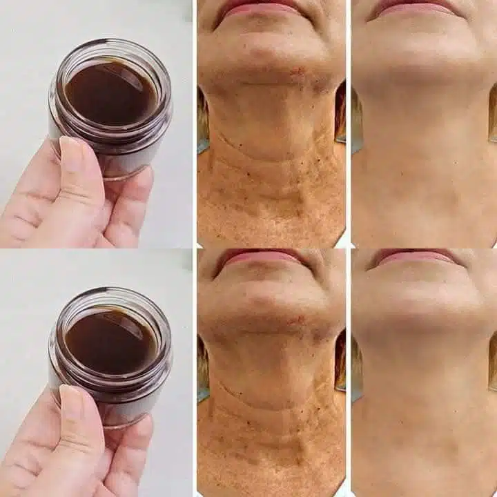 Comment rajeunir le visage naturellement