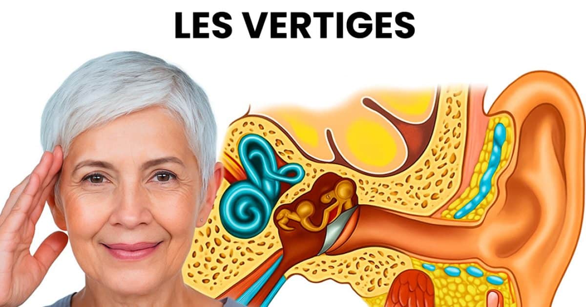 Comment se débarrasser des cristaux de l’oreille interne et réduire les vertiges