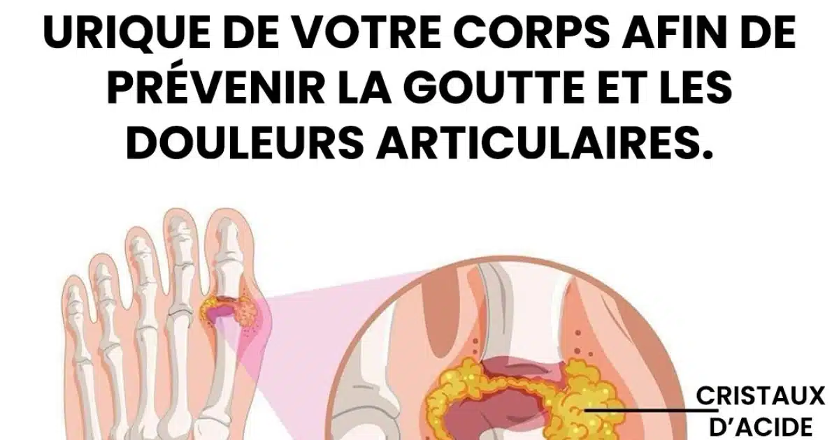 Comment soulager naturellement la goutte et les douleurs articulaires