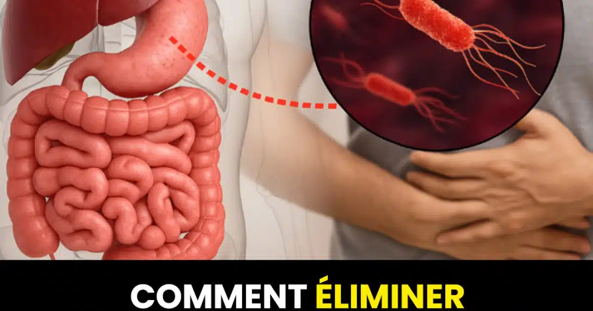Comment traiter H. Pylori (Helicobacter Pylori) naturellement