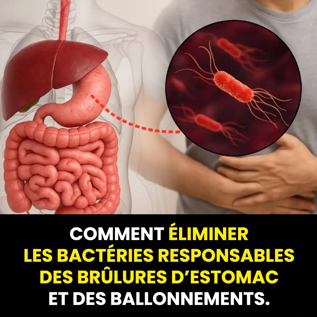 Comment traiter H. Pylori (Helicobacter Pylori) naturellement