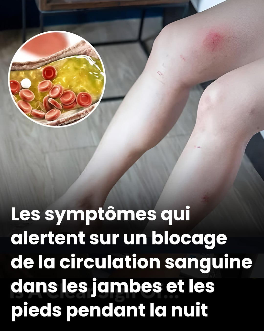 Comment vos pieds pourraient signaler des problèmes cardiaques et des artères obstruées