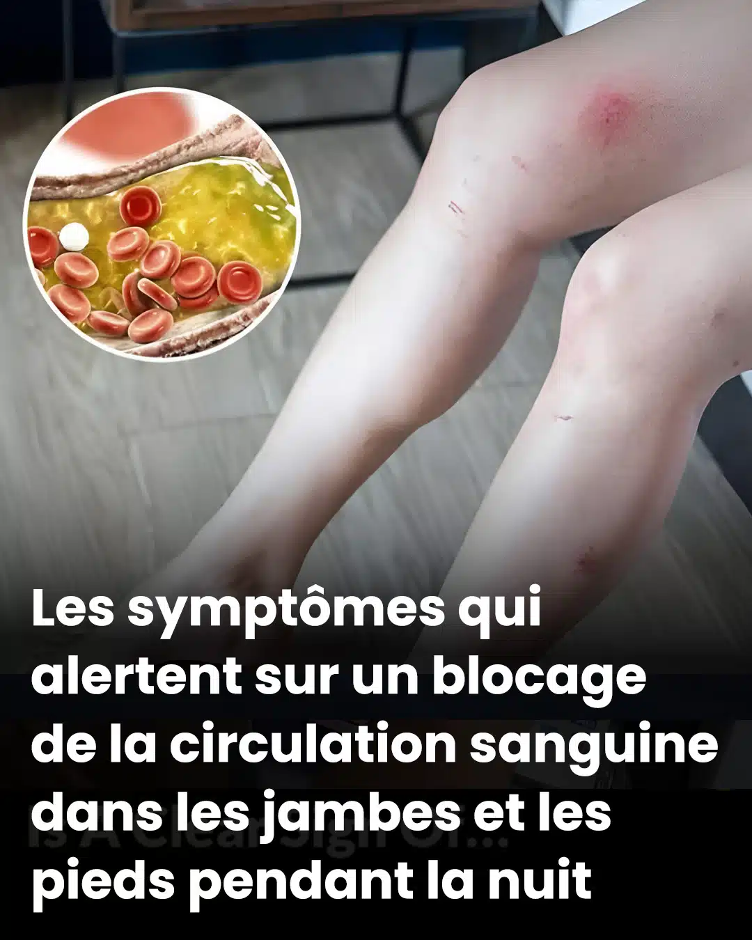 Comment vos pieds pourraient signaler des problèmes cardiaques et des artères obstruées