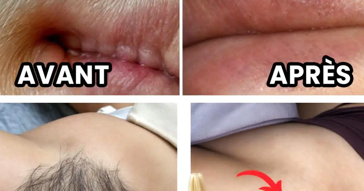 Comment vous débarrasser définitivement des poils du visage et du corps