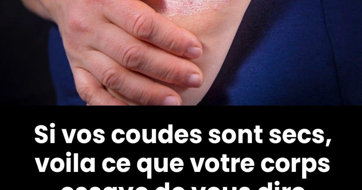 Coudes secs : symptôme courant ou avertissement de quelque chose de plus grave ?