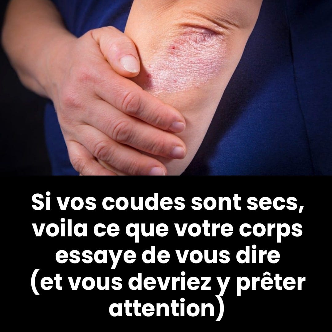 Coudes secs : symptôme courant ou avertissement de quelque chose de plus grave ?