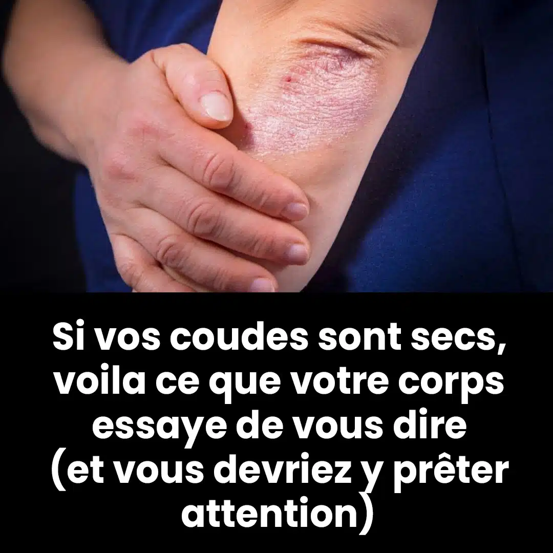 Coudes secs : symptôme courant ou avertissement de quelque chose de plus grave ?